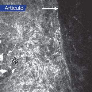 News Nota4 17 02 2022 Oald 1 300x300 1