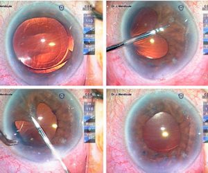 Imagen DentroDeLaSeccion 360x300 300x250 1