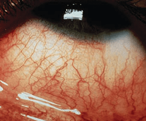 Imagen Interna Nota Nota3 2021 06 16 Oald