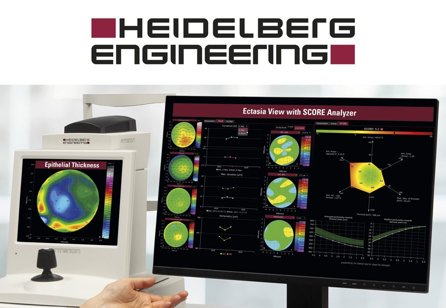 Grafik Bild ANTERION Neue Features 1