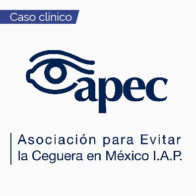 Ptosis palpebral como manifestación inicial de linfoma conjuntival en un paciente joven News Nota2 13 07 2022 Oald