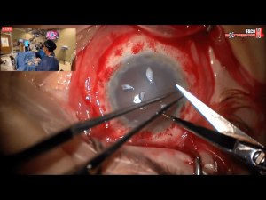 01cirugiaextrema11 Nota1 2021 09 15 Oald 300x225