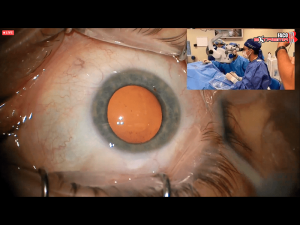 03cirugiaextrema11 Nota1 2021 09 15 Oald 300x225