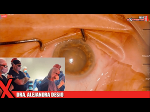 04cirugiaextrema11 Nota1 2021 09 15 Oald 300x225