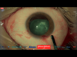 05cirugiaextrema10 Nota1 2021 09 15 Oald 300x225