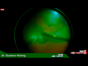 06cirugiaextrema10 Nota1 2021 09 15 Oald 300x225