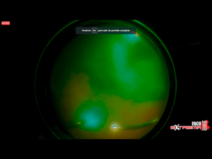 07cirugiaextrema10 Nota1 2021 09 15 Oald 300x225