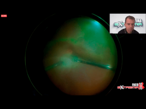 08cirugiaextrema10 Nota1 2021 09 15 Oald 300x225