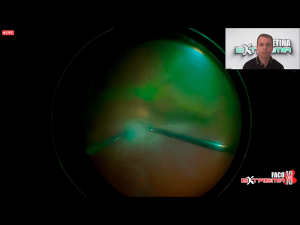 09cirugiaextrema10 Nota1 2021 09 15 Oald 300x225
