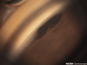 GS Img013 R IN BF 300x225 1