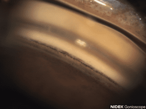 GS Img048 L IIN BF 300x225 1