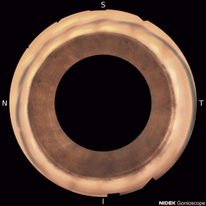 GS Stitching Circular 300x300 1