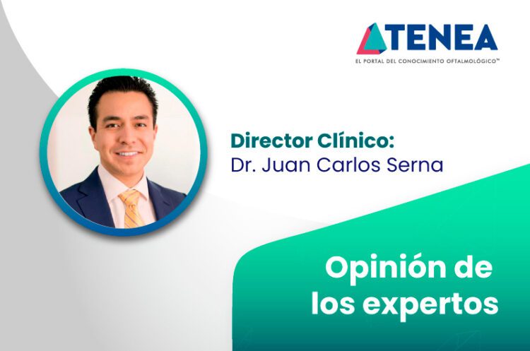 Opinión de los expertos