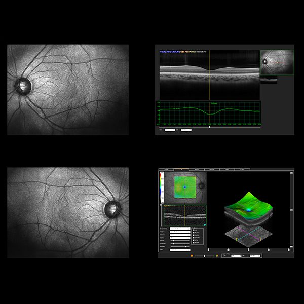 600x600 Nota5 04 10 2022 Oald