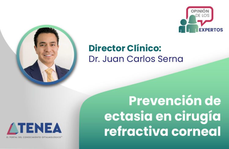 Prevención de ectasia en cirugía refractiva corneal