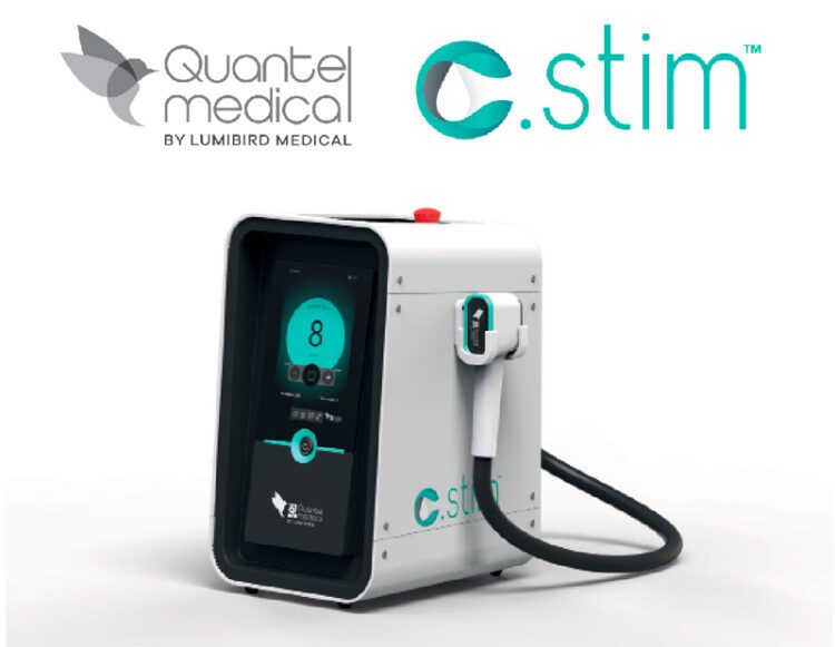 C.STIMTM: nuevo sistema I.P.L para el tratamiento del ojo seco