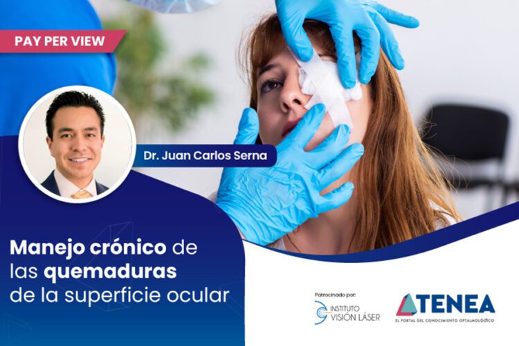 Manejo crónico de las quemaduras de la superficie ocular