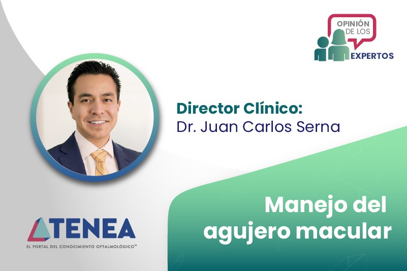 img opinion de los expertos manejo del agujero macular web