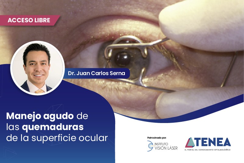 Manejo agudo de las quemaduras de la superficie ocular img manejo agudo de las quemaduras de la superficie ocular web acceso libre