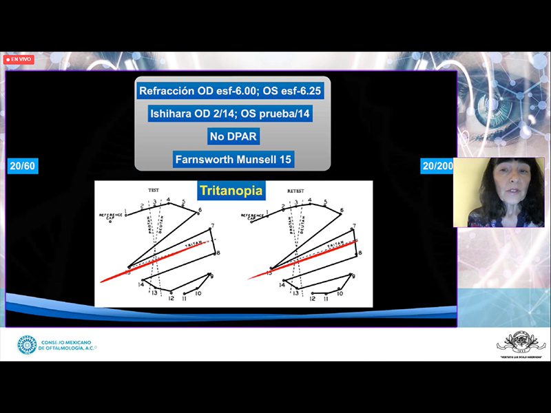 11galeria Nota4 08 03 2023 Oald