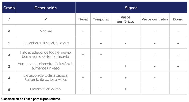 Tabla de Clasificacion-de-Frisen-para-el-papiledema