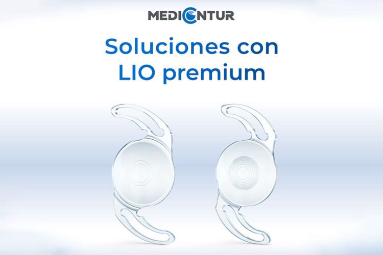 Medicontur desarrolló la tecnología Wavefront Linking