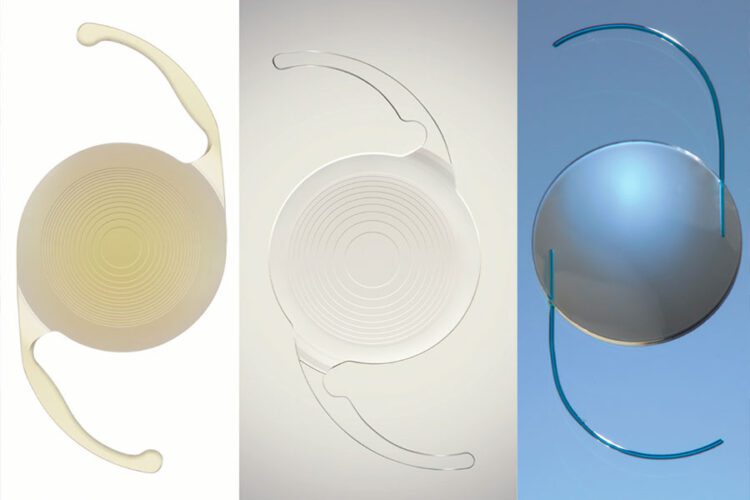 Un repaso a la cirugía facorefractiva