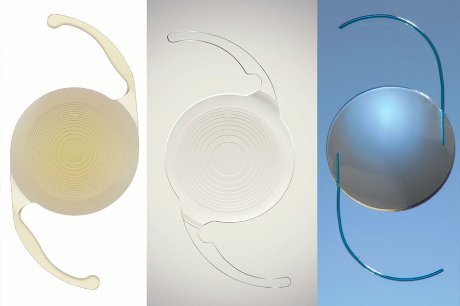 Un repaso a la cirugía facorefractiva Paginaweb Nota5 29 03 2023 Oald