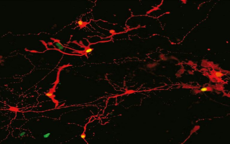 Las células retinianas cultivadas en laboratorio pueden abrir la puerta a la restauración de la visión Las Neuronas 1 768x482