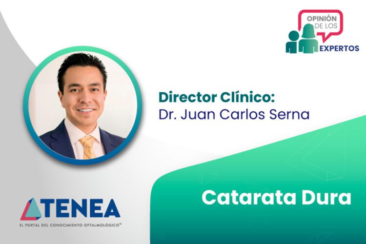 Catarata dura