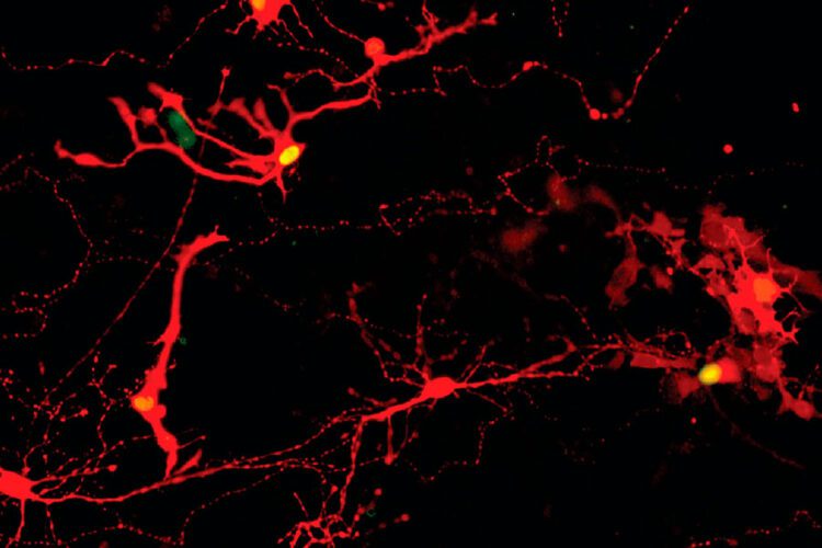 Las células retinianas, cultivadas en laboratorio, pueden abrir la puerta a la restauración de la visión