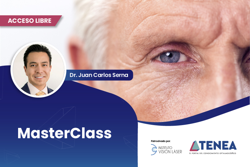 Manejo de edema corneal después de cirugía de catarata 25 jul web acceso libre