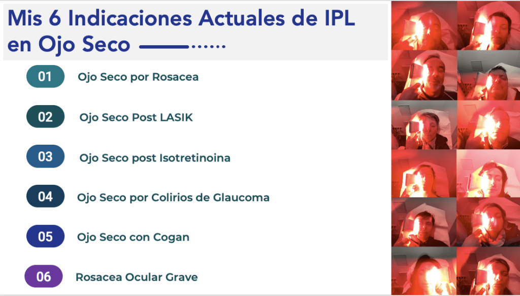 Indicaciones IPL 1024x583