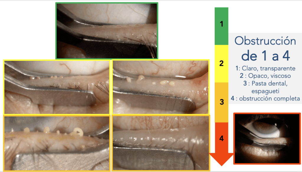 Obstruccion 1024x583