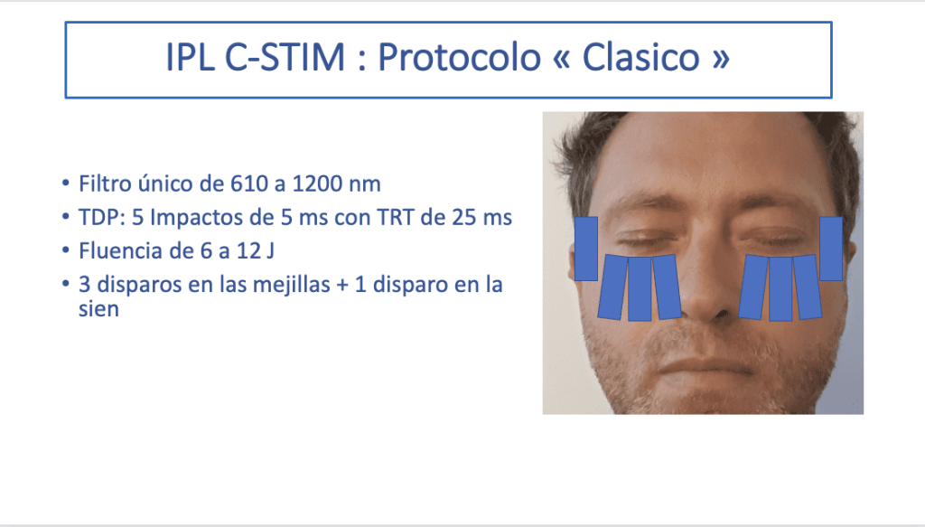 Protocolo IPL 1024x583