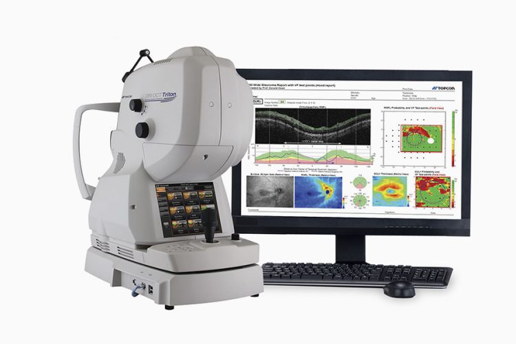 Detectando Glaucoma con OCT