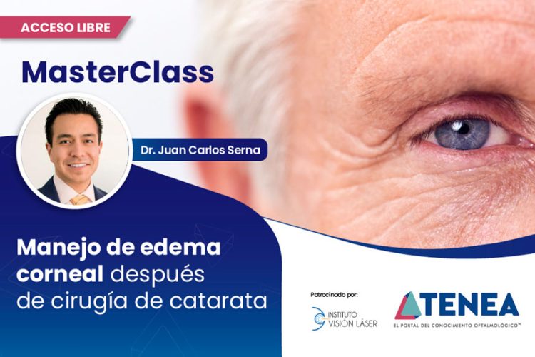Manejo de Edema Corneal después de Cirugía de Catarata