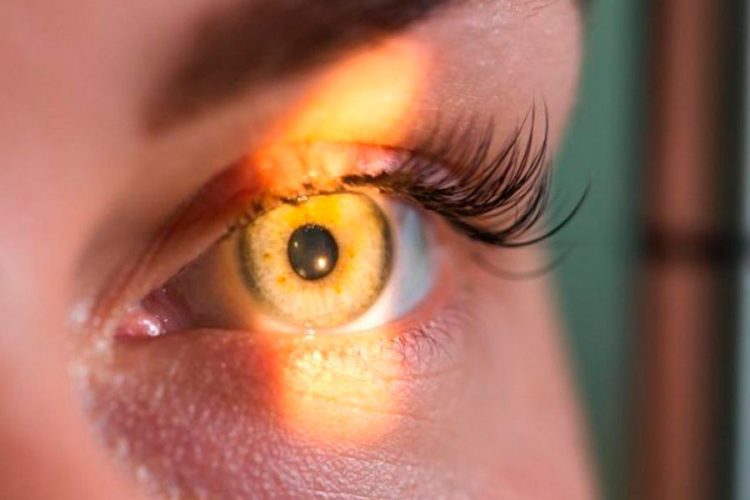 Manejo de la RDNP severa: opciones Anti-VEGF y más