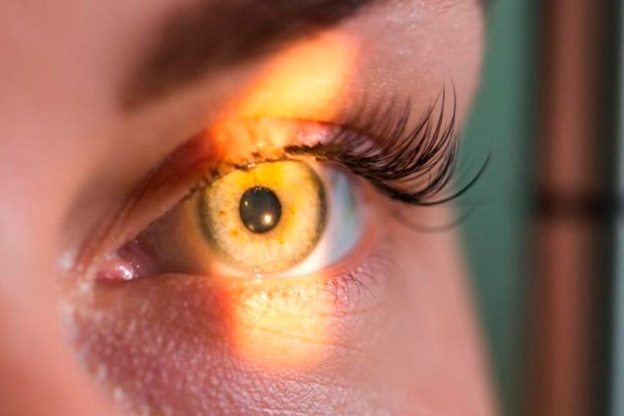 Manejo de la RDNP severa: opciones Anti-VEGF y más Paginaweb Nota4 20 09 2023 Oald