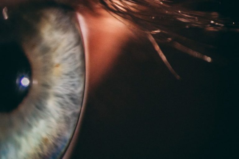 Una nueva investigación analiza la coriorretinopatía serosa central Paginaweb Nota5 16 08 2023 Oald 768x512