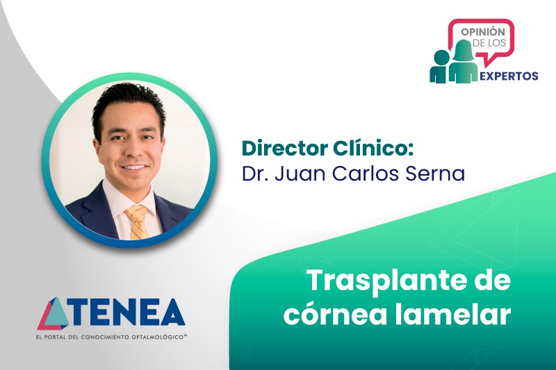 img. opinion de los expertos trasplante de cornea lamelar web