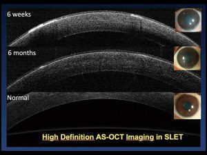 1 Avances En Cirugia 300x225