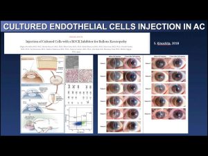 3 Avances En Cirugia 300x225