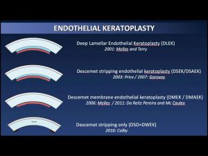 4 Avances En Cirugia 300x225
