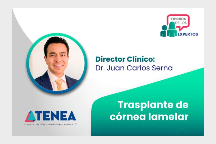 Trasplante de córnea lamelar