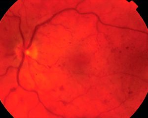 013 Rp1023 News 300x240