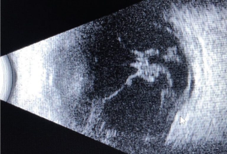 Oct Rp F4 2 Copia 768x521