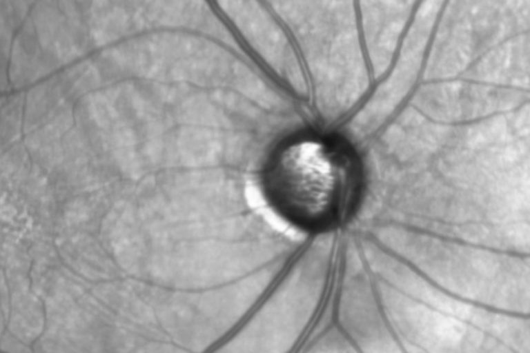 Paginaweb Nota3 210224 Oald 768x512