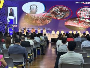 06Facocaribe Nota1 130324 Oald 300x225