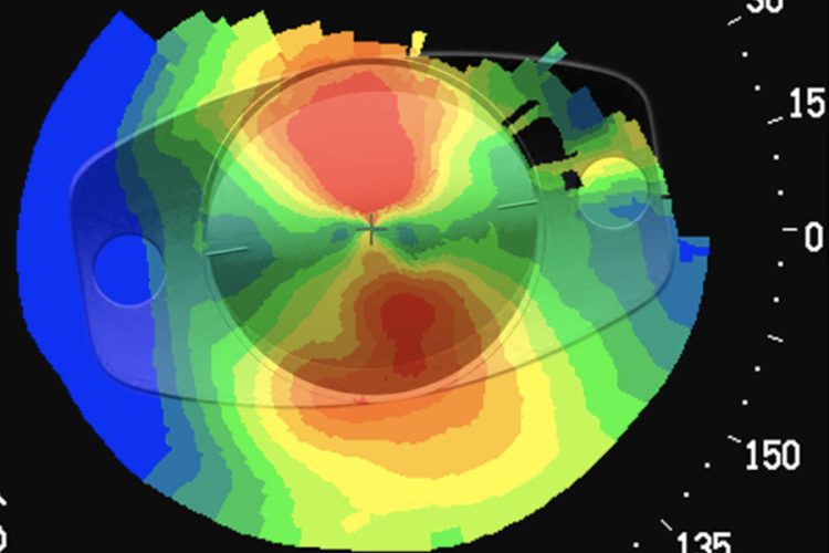 Asegurar la felicidad premium del paciente